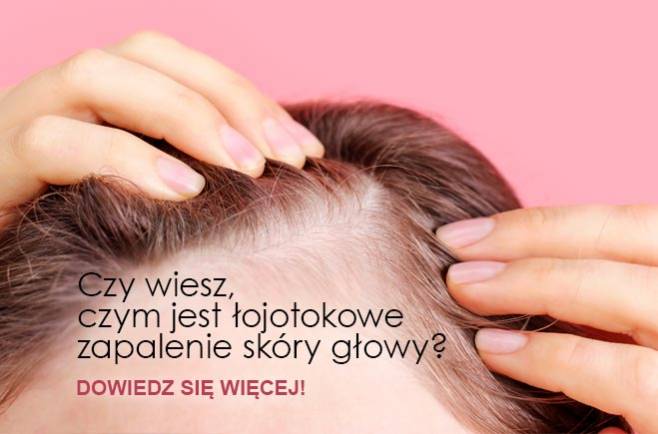 Czy wiesz, czym jest łojotokowe zapalenie skóry głowy? Dowiedz się więcej!